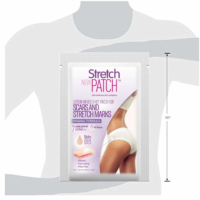 StretchPatch ORIGINAL Formula, Lotion Infused Hot Patch for Scars and Stretch Marks, 7 ea (20 x 15cm)