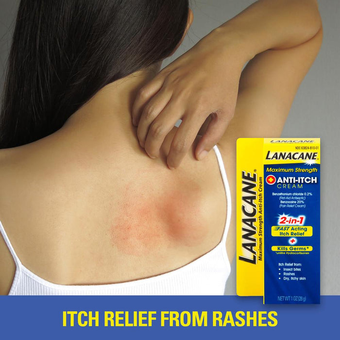 Lanacane Maximum Strength Anti-itch Cream, 1 oz., 2in1 Fast Acting Itch Relief and Kills Germs